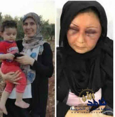 شاهد.. البحرين: منظر مؤلم لسورية بعد اعتداء زوجها عليها يثير امتعاضاً واسعاً.. والشرطة تقبض عليه