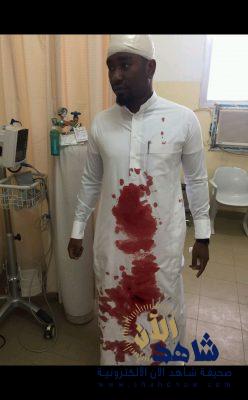 طالب يشج رأس معلم بعصا غليظة بالباحة