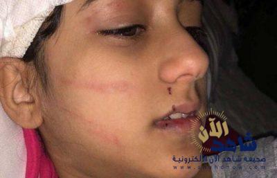 مايا بخش طفلة السوشيال ميديا تنجو من نمر في مزرعة شمال جدة