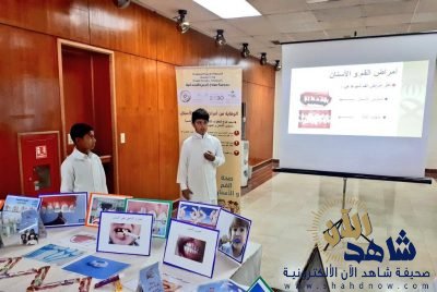 الصحة العامة بصحة الأحساء تدشن المبادرة الوطنية للوقاية من تسوس الأسنان