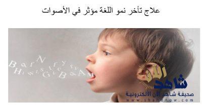 56 سيدة بمحاضرة اضطرابات النطق والتخاطب في معهد فتاتي العالي