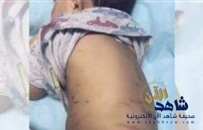 والدة الطفل ضحية كلاب الأحساء تفاصيل الفيديو المروع
