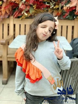 لسبب غريب.. مدرسة تفصل طالبة مصـابة بتشوه.. وأسرتها ترفع شكوى لـ “التعليم”