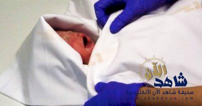 التشيك: ولادة طفلة بعد بقائها في رحم أمها المصابة بموت دماغي لـ117