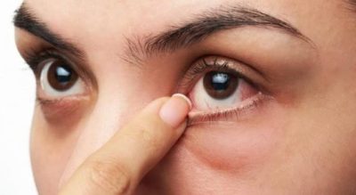 استشارية: 7 عوامل داخلية وخارجية تسبب جفاف العين