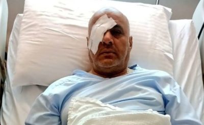 (العلي)..  يخضع لمشرط الجراح.. ونجاح عملية إزالة المياه البيضاء